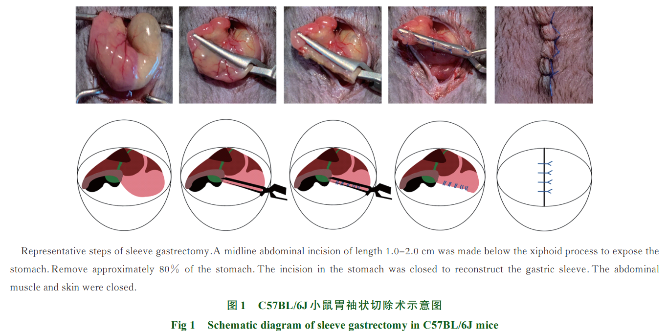 肥胖外科手术研究(图1)