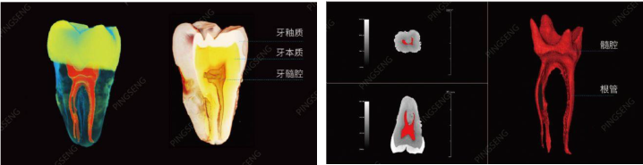 微焦点CT成像(图5)